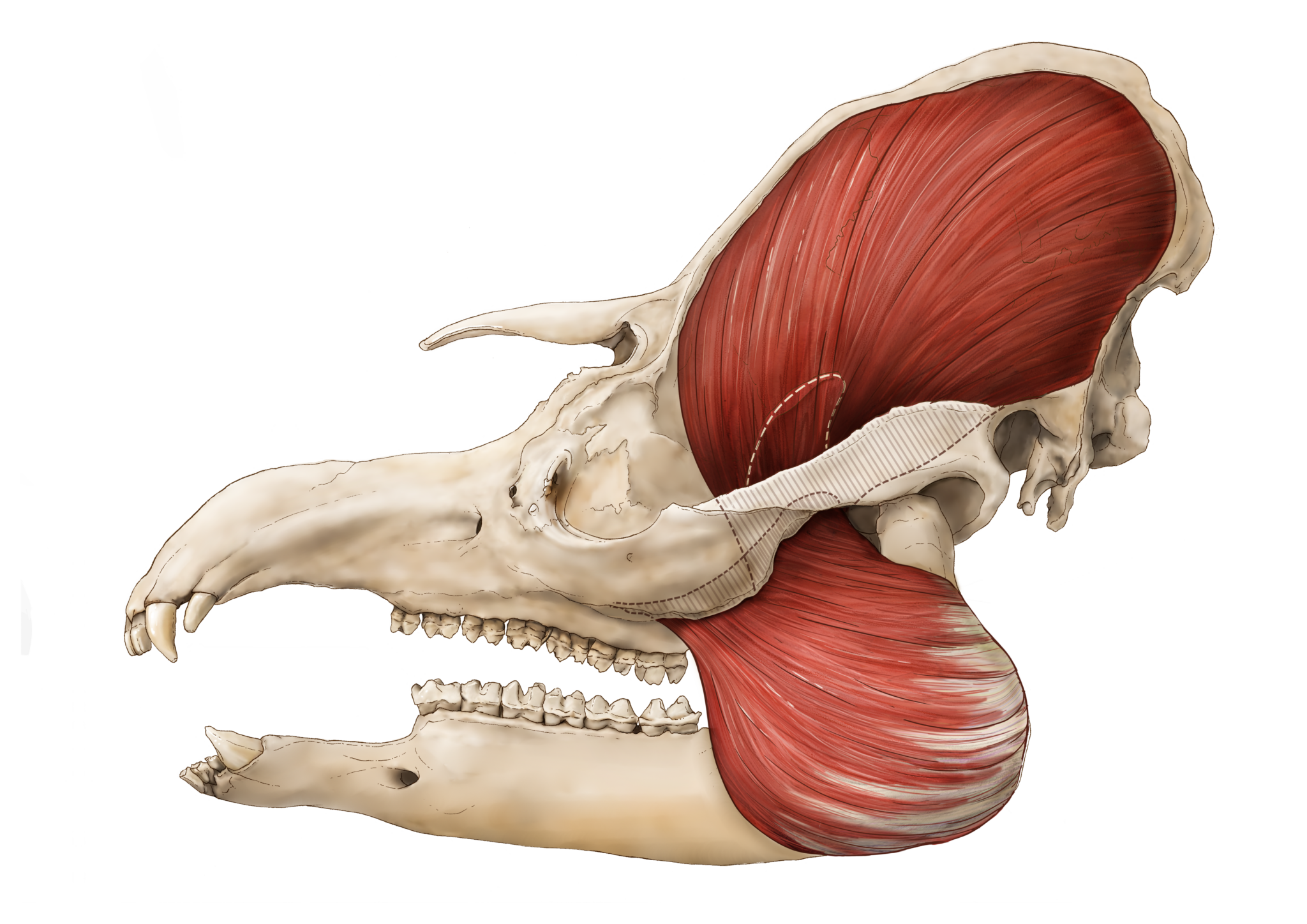 Masseter + temporalis